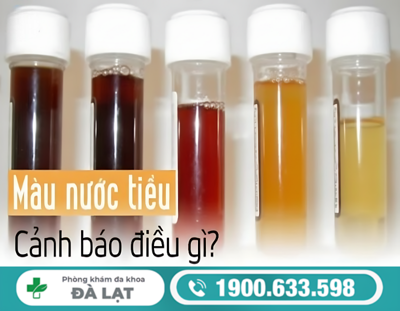 Hình ảnh minh họa